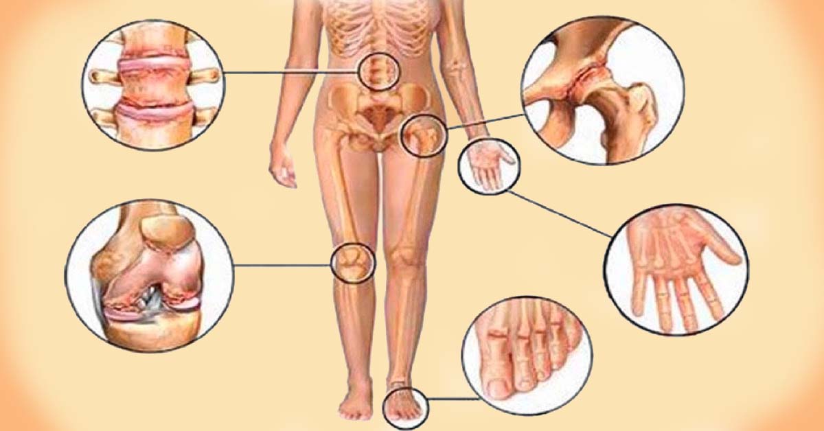 skausmas nuo priežastis ir gydymo tepalas ranka sąnarių artrozė iš alkūnės sąnarių