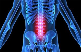 nugaros osteochondrozė nuo skausmo kaulų ir sąnarių