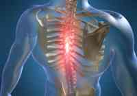 uždegimas sąnarių osteochondrozė kas padės su artritu sąnarių