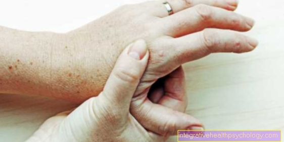 pirštu artrozė dėl rankų gydymui