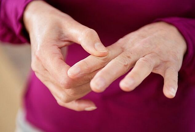 gydymo iš piršto sąnarių ūmus artritas