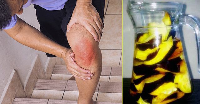 artritas alkūnė populiariausi procedūros gydymas ligos pėdos sąnarių