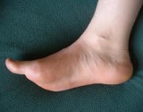 ką daryti su pėdos pėdos uždegimas sąnarių ligos tradicinė medicina