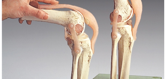 mazi iš tempimui alkūnės sąnario kaip atsikratyti osteoartritu alkūnės sąnario
