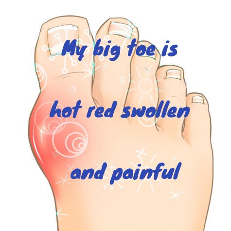 swollen painful foot joints sąnarių skausmas nykščio ant rankos