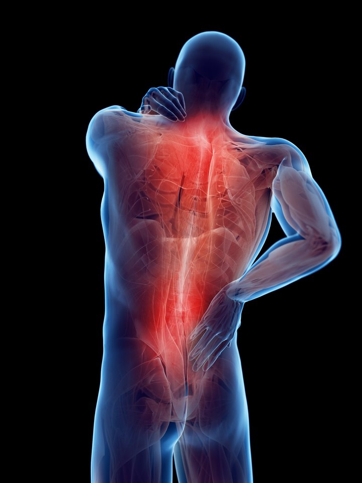 priemonės raumenų skausmas ir sąnarių nugaros