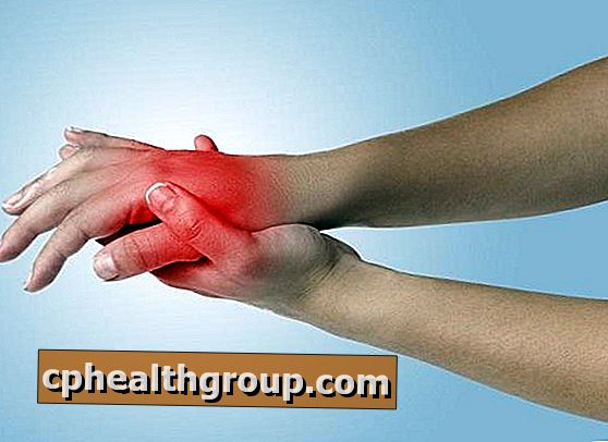 rekomendacijas dėl osteoartrito gydymui skauda ranku riesus