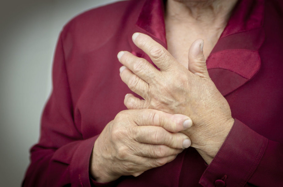 riešo kanalo sindromas forumas primulely pakabinamų sąnarių artritas