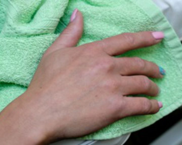 tepalas yra uždegimas pirštų rankų gydymo sąnarių dots dėl sąnarių gydymo