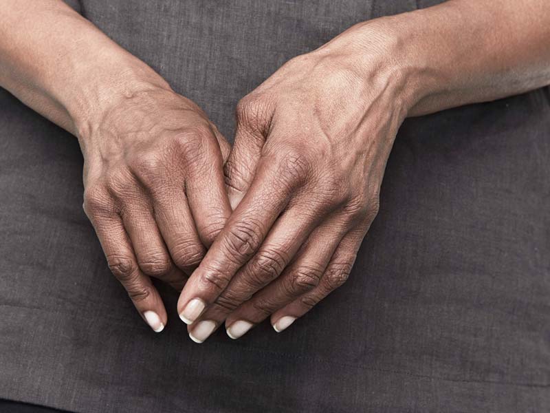 artritas sustaines iš rankų