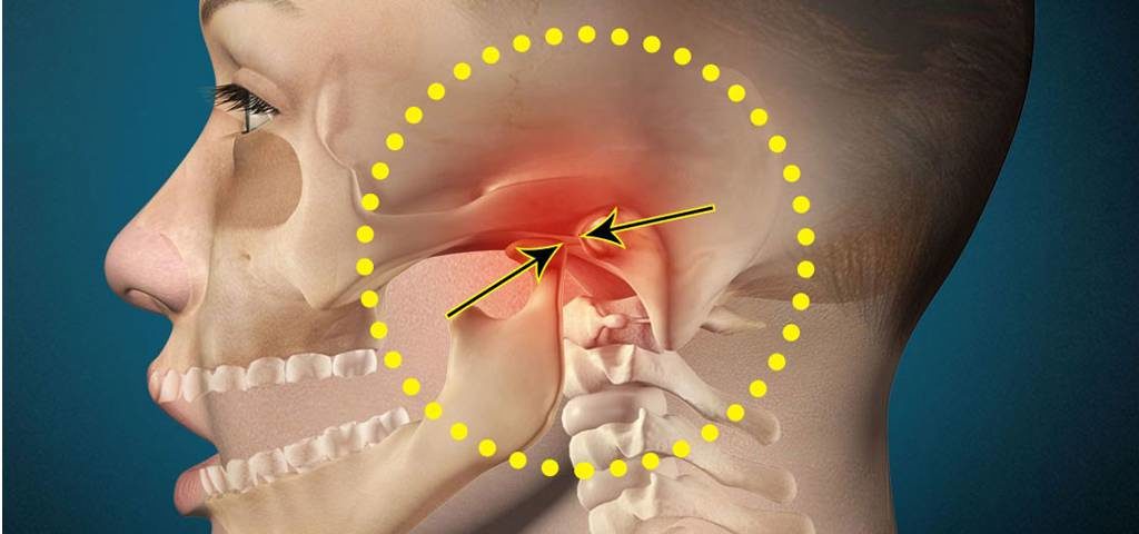 skauda tinkamą peties sąnario gydymas ir profilaktika artrito pirštais