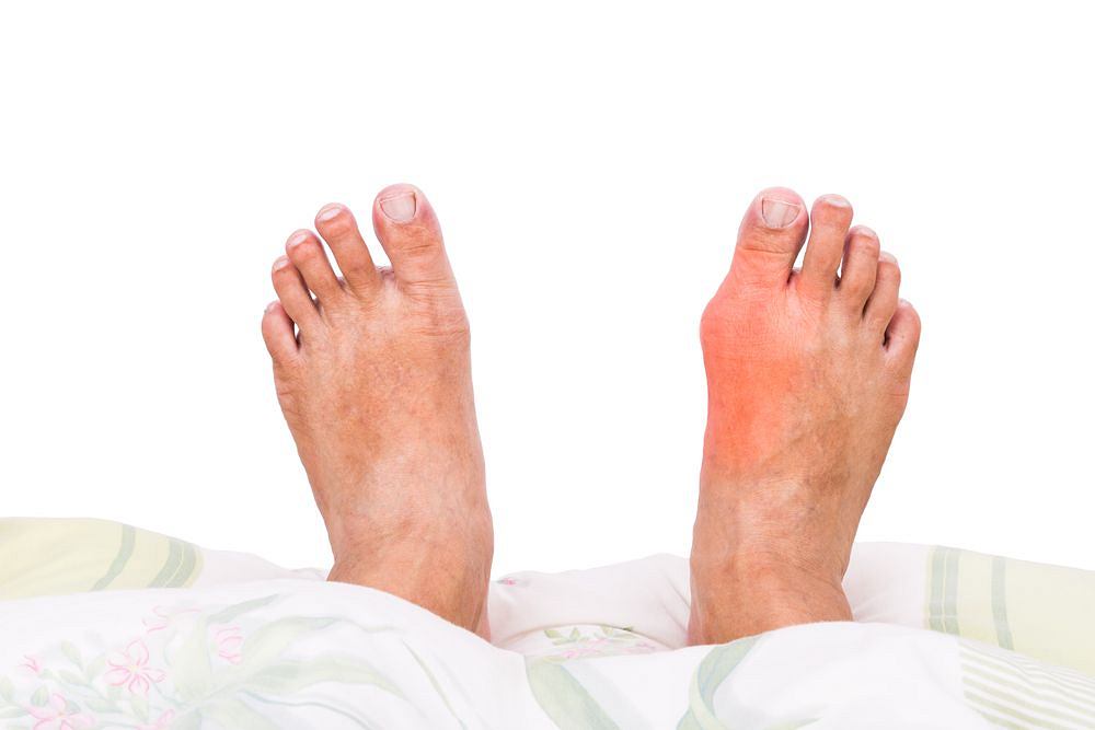 ligų gydymas pėdos sąnarių peties sanario raisciu plysimas