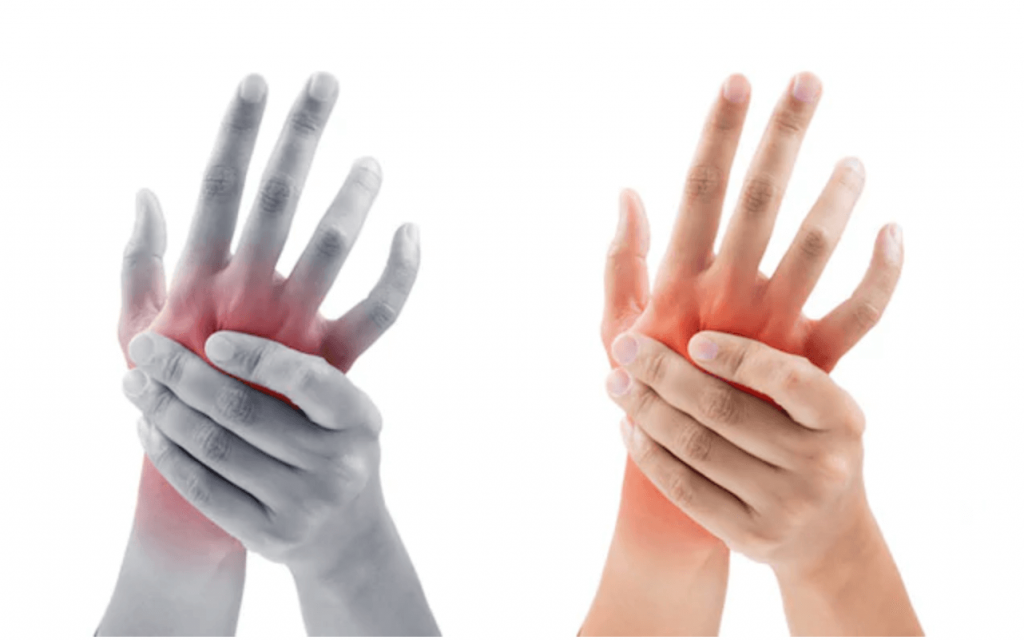 rankos bendra dešinė ranka sanariu skausmas