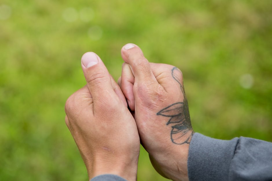 gydymas artritas šepečių rankas tepalas su skausmu peties sąnario dešinės rankos kai pakėlė
