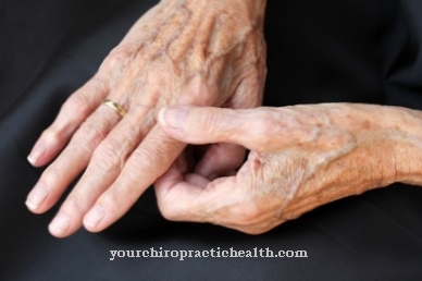 gydymas artritas šepečių rankas kaklo osteochondrozė ir kraujo spaudimas