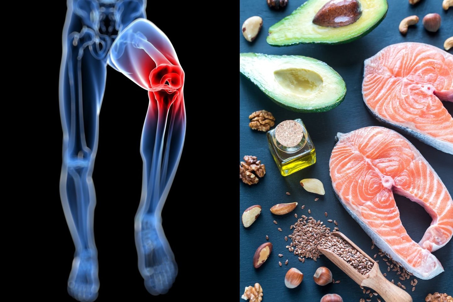 maisto ir sąnarių ligos tepalas už osteoartrozės peties sąnario gydymo