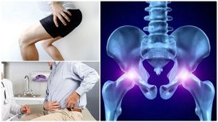peties sąnario osteochondrozės gydymo atsiliepimus