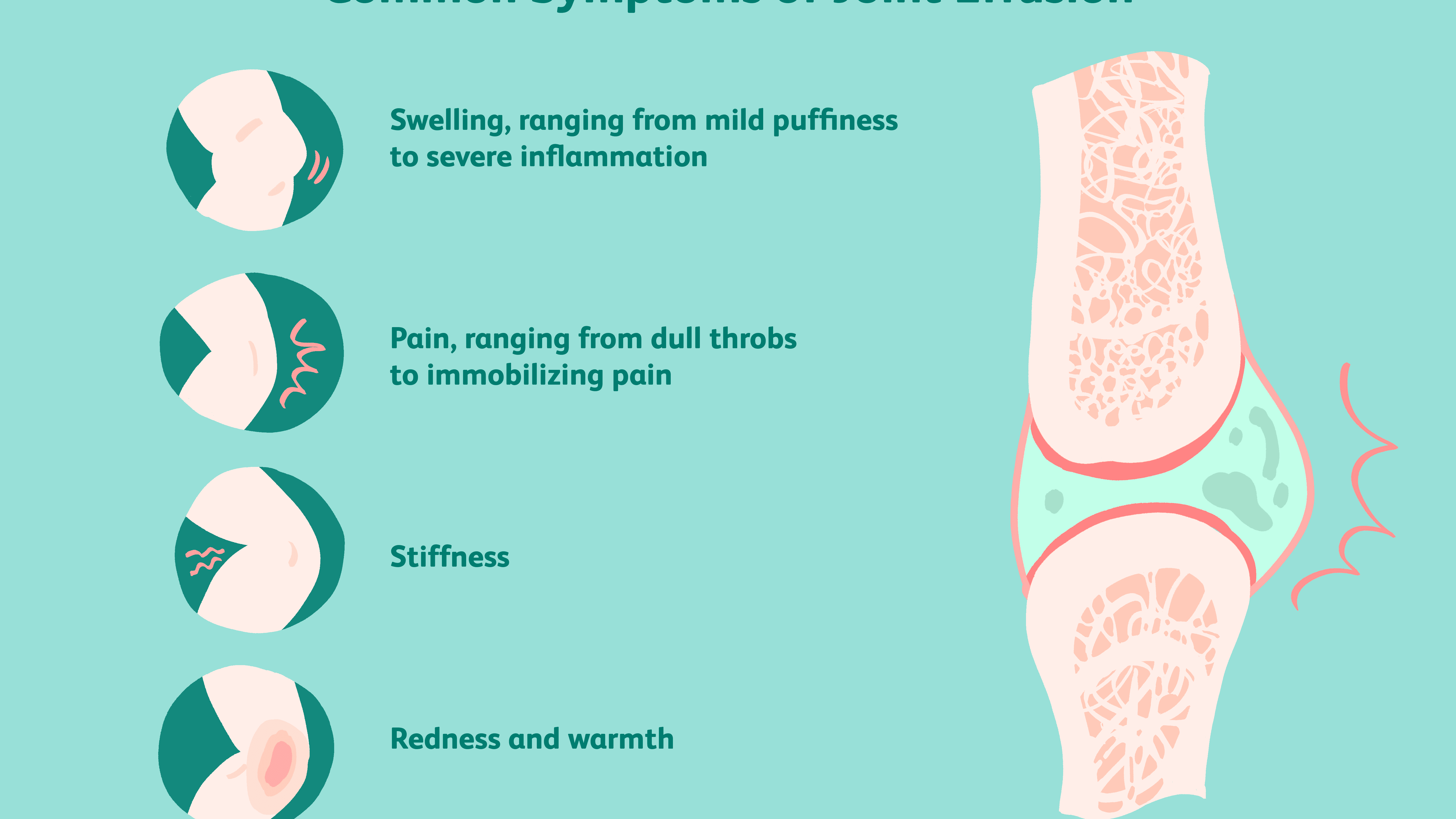 swelling in various joints staigus pėdų skausmas