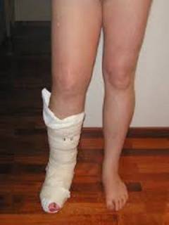 swells apatinėje kojos sąnarį gydymas šlaunies sąnarių