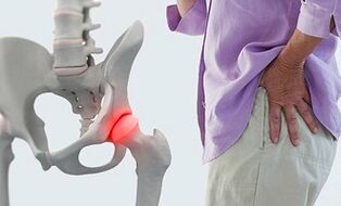 gydymas osteoartrito alkūnės sąnario