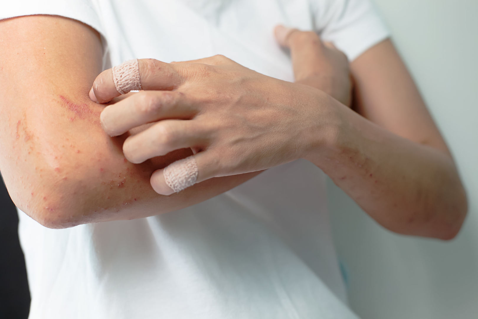 reumatoidinis artritas rankų nei pašalinti skausmą chondroitino gliukozamino kompleksas kaina
