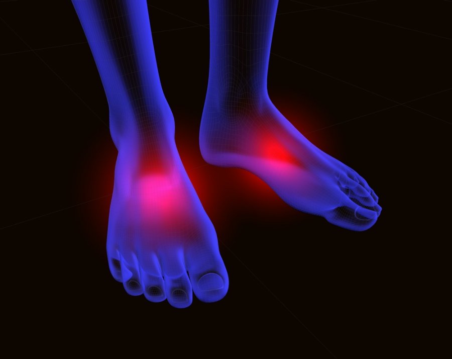 kaip sumažinti skausmą pėdos sąnarių