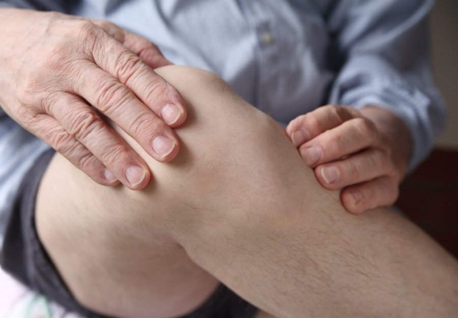 įmanoma sąnarių liga artritas bendras šepečiai gydymas