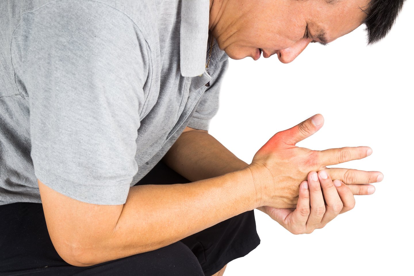 artritas iš veido bendros prevencijos reumatoidinis artritas ant rankų