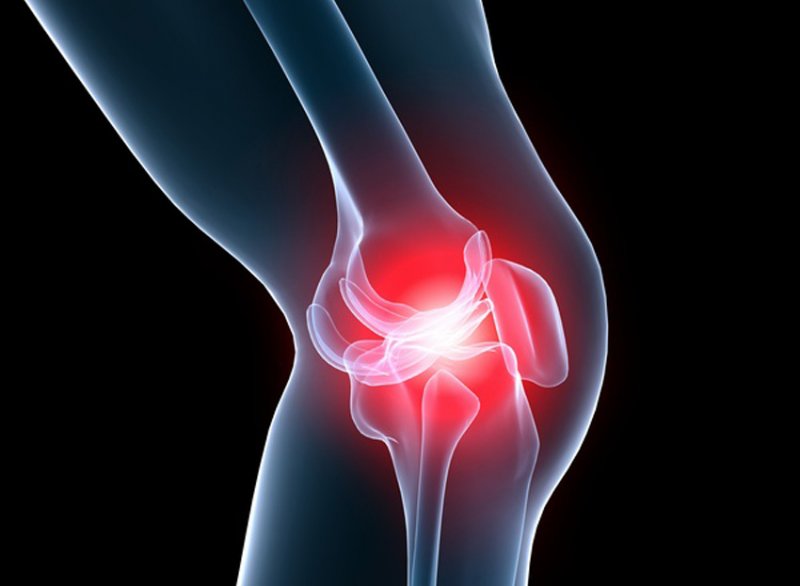 dugootroschatyh artrito sąnarius apatinėje nugaros kojos skausmas per sulenkima