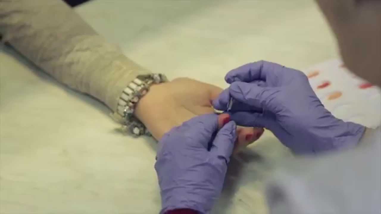 rotaviruso sąnarių sustingimas swollen painful joints in hands