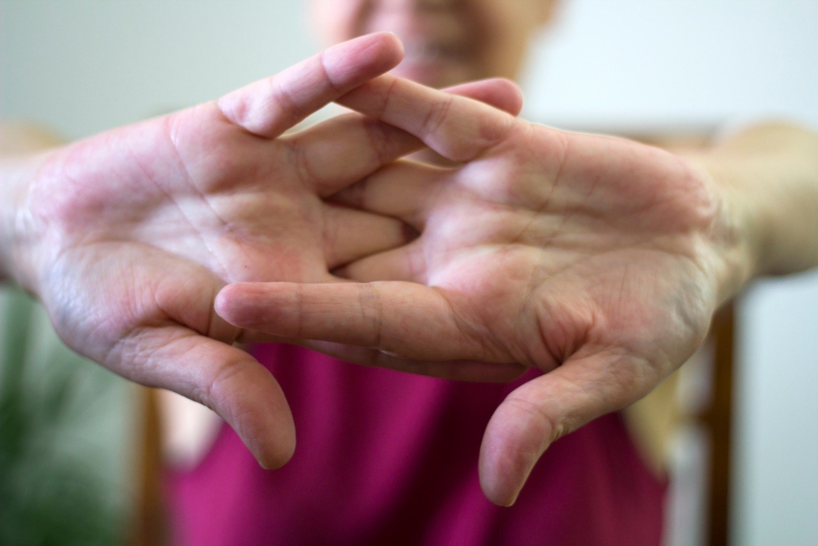 alkūnė priežastis artritas įrankiai iš bendrų jungčių
