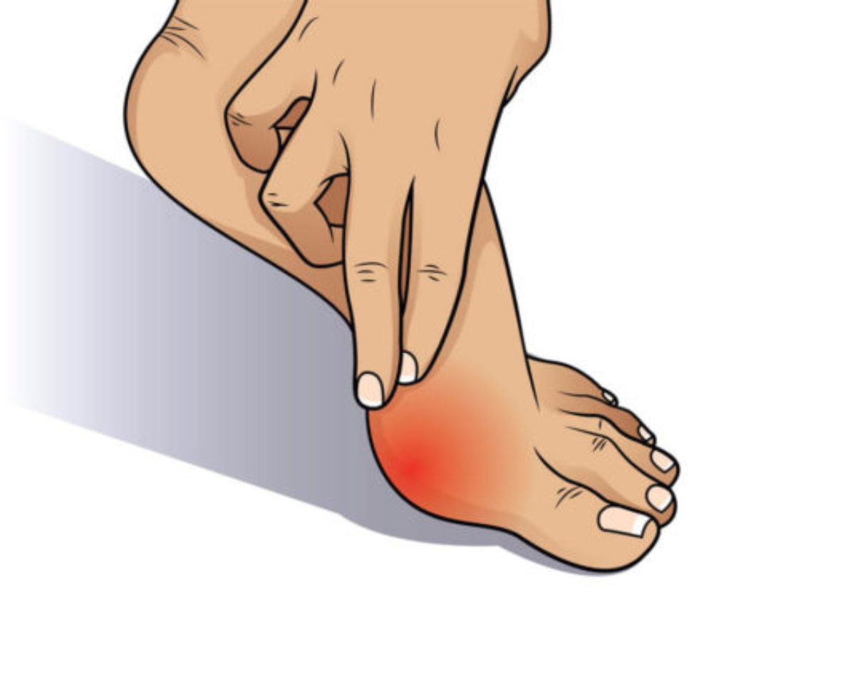 skausmas big foot palaikimo išlaikyti uždegimą žandikaulio