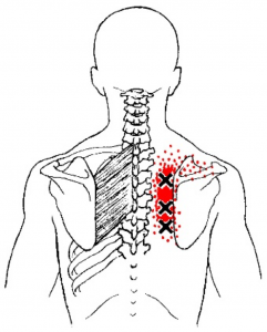 skausmas dešinėje pusėje po krūtine skauda sąnarį šlaunies iš nugaros