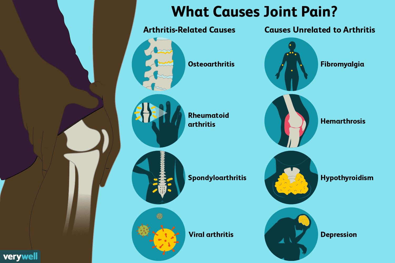 swelling in joints causes